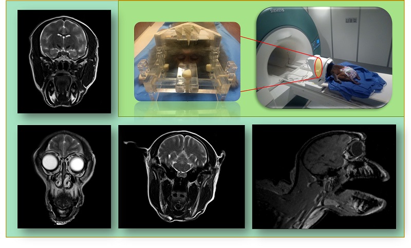 Anatomical Brain Imaging